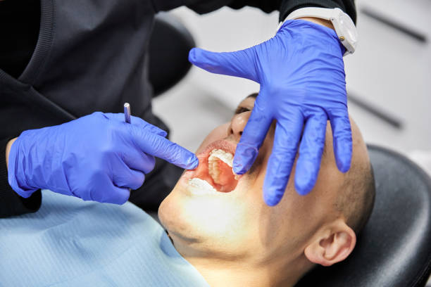 Best Emergency Wisdom Tooth Extraction in Garland, UT
